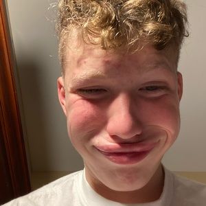 Meet your Posher, Billy